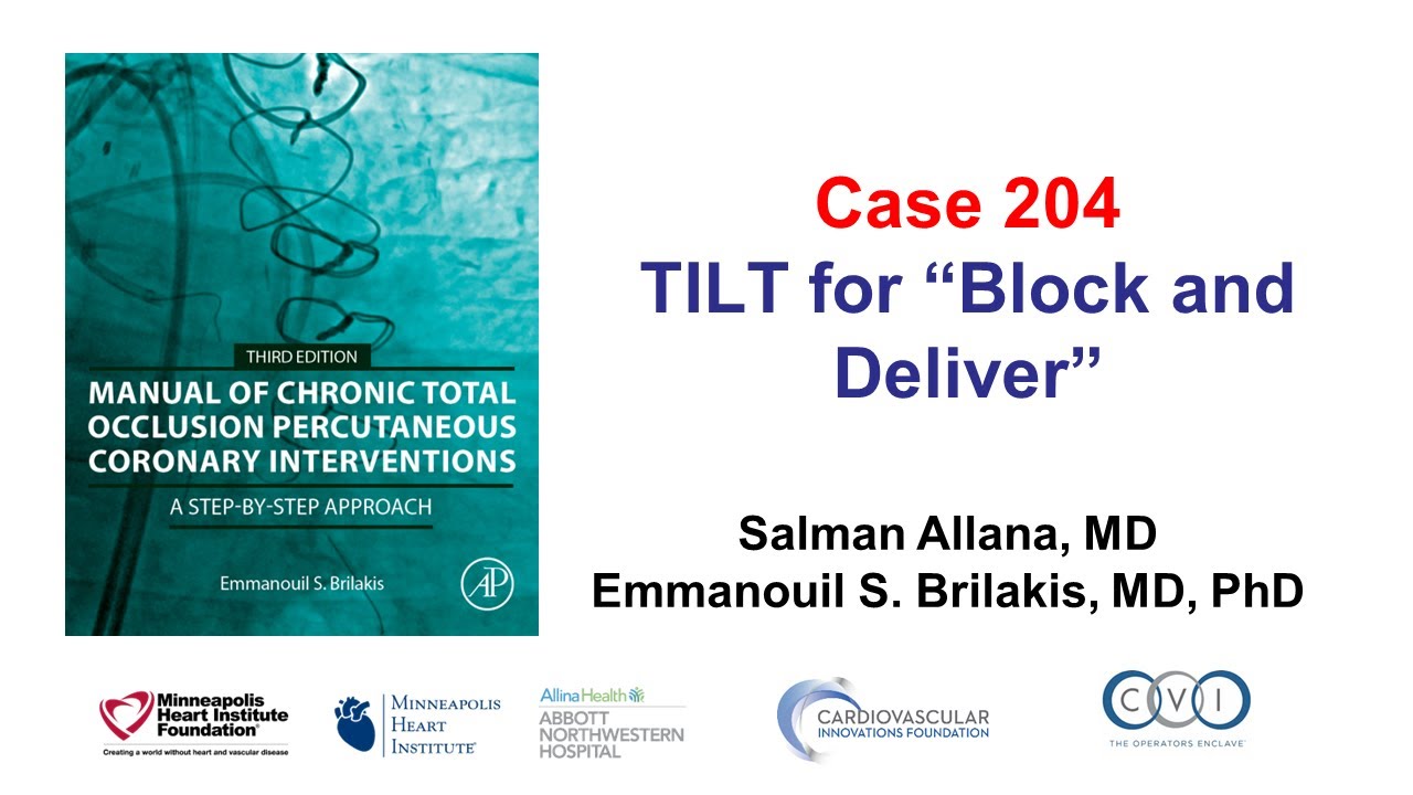 Case 204: Manual of CTO PCI -  TILT for block and deliver