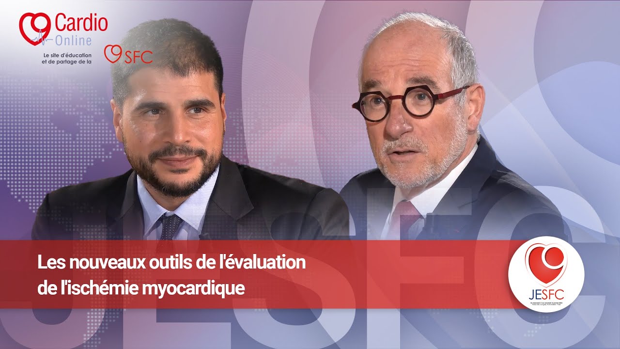 Les nouveaux outils de l'évaluation de l'ischémie myocardique