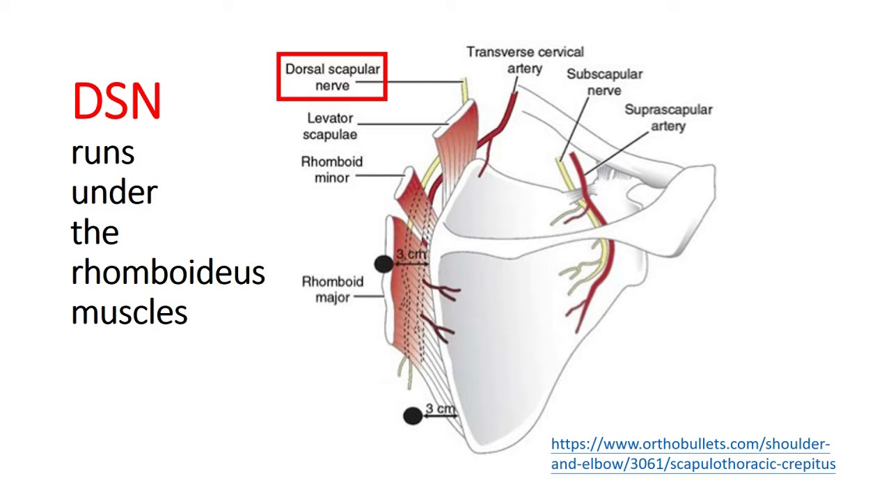《USG Pain Hydrodissections》 Part 0: Accurate Diagnosis