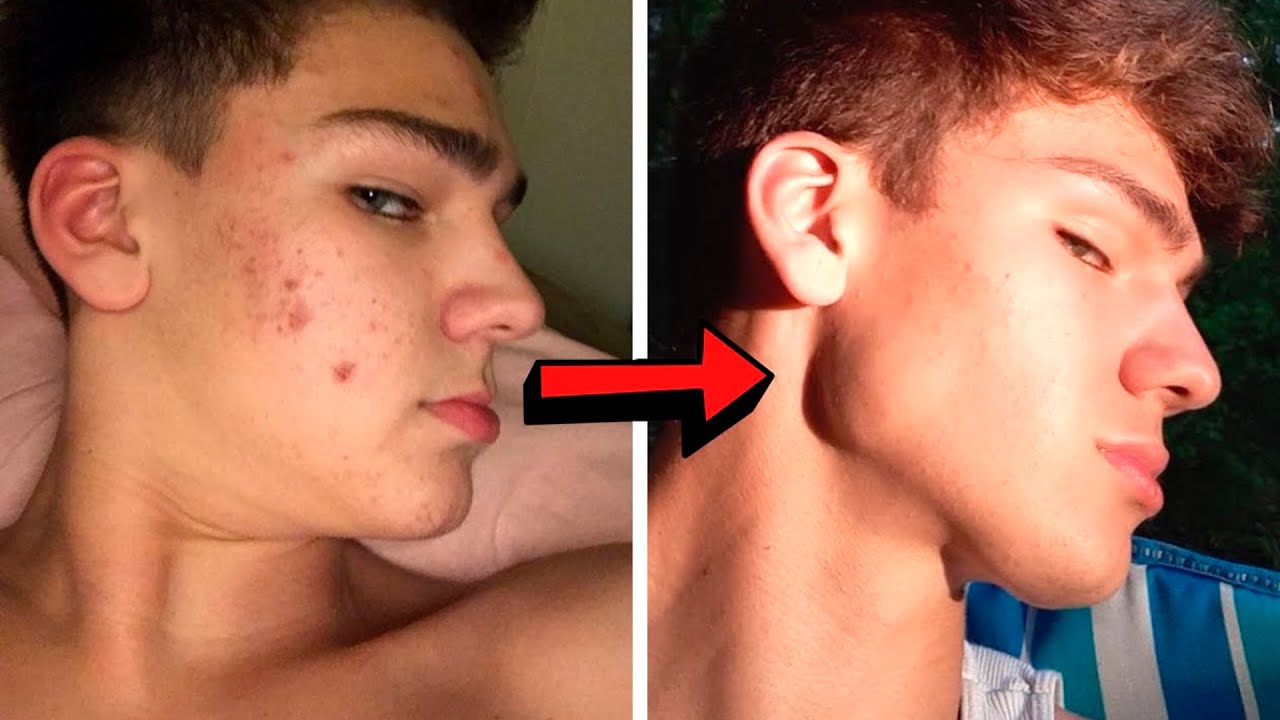 O resultado de BONS HÁBITOS! Evolução @Brae