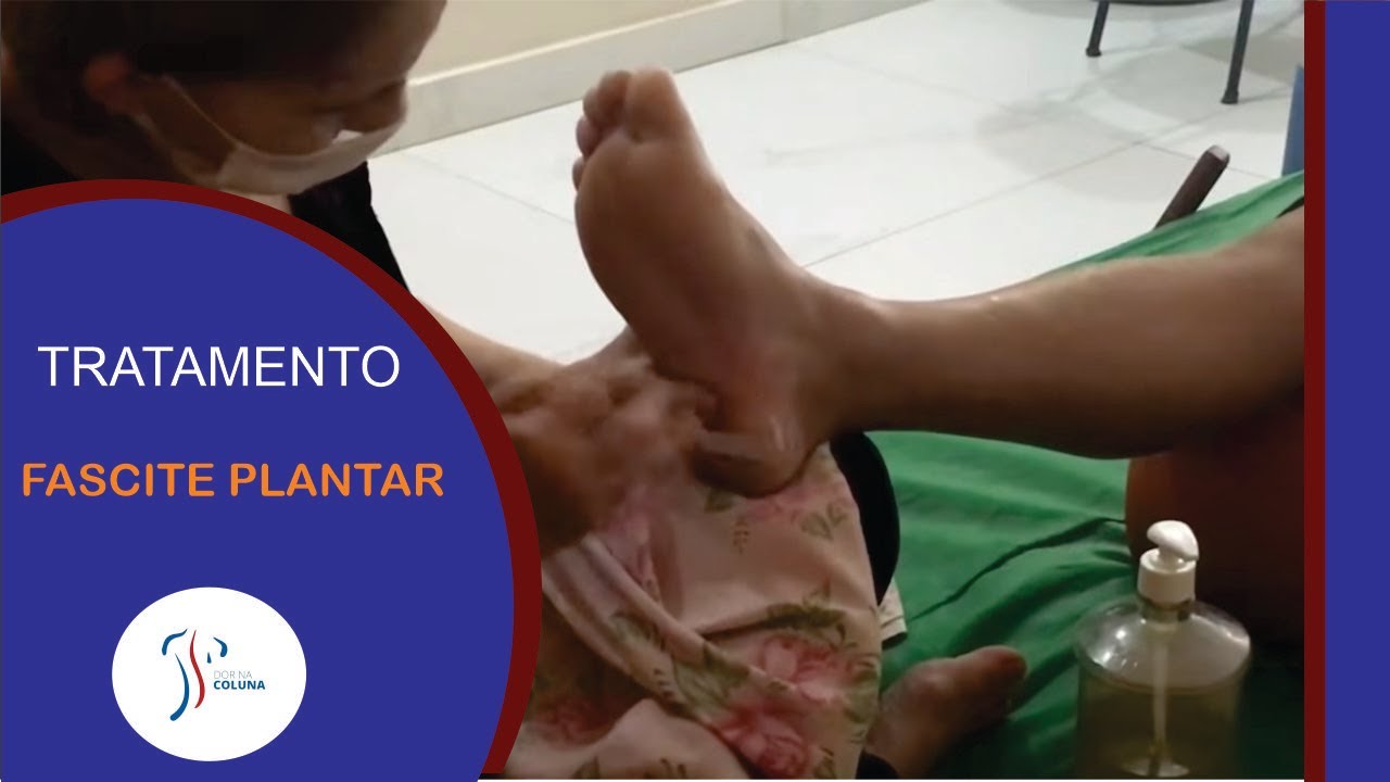 DOR NO PÉS - Fascite Plantar