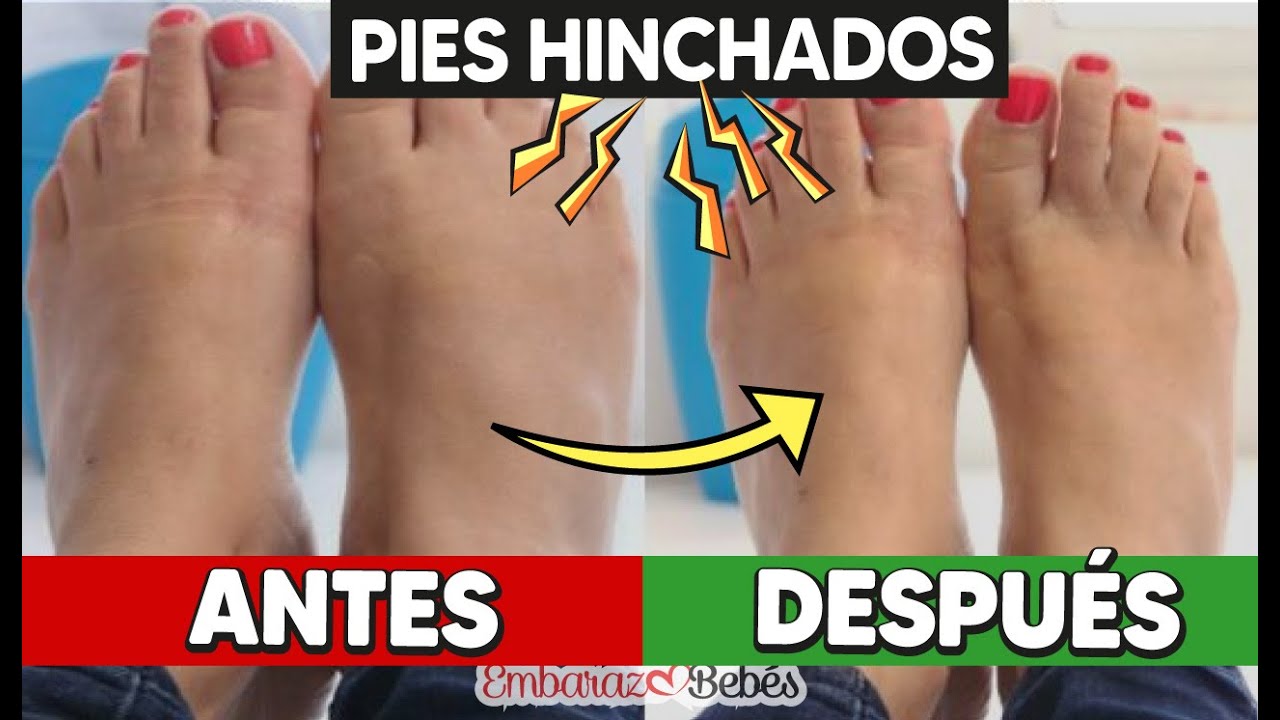 🦶🏻🔥 4 FORMAS de disminuir los PIES HINCHADOS durante el embarazo