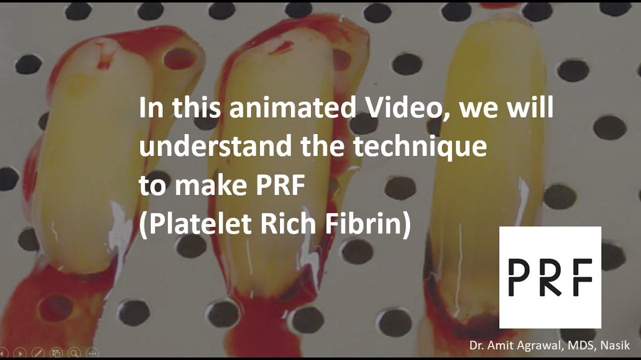How to make PRF, Animated video