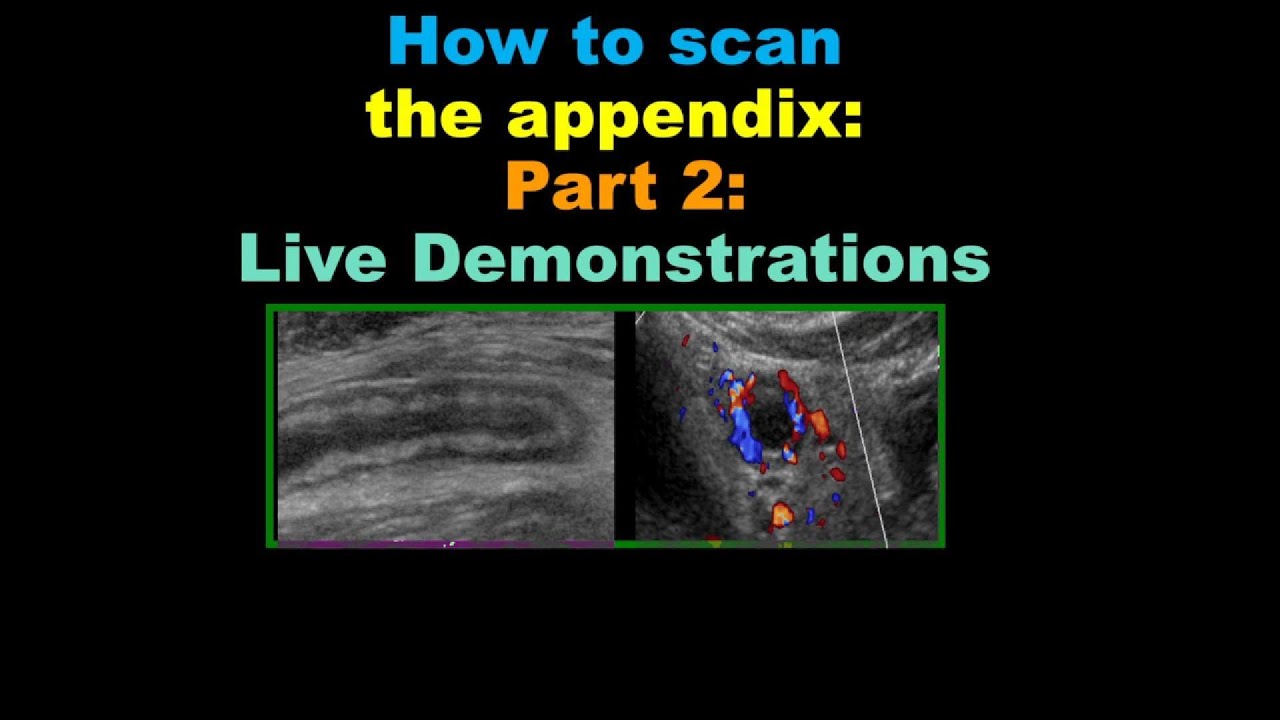 art 2: How to Scan the Appendix – Live Demonstrations