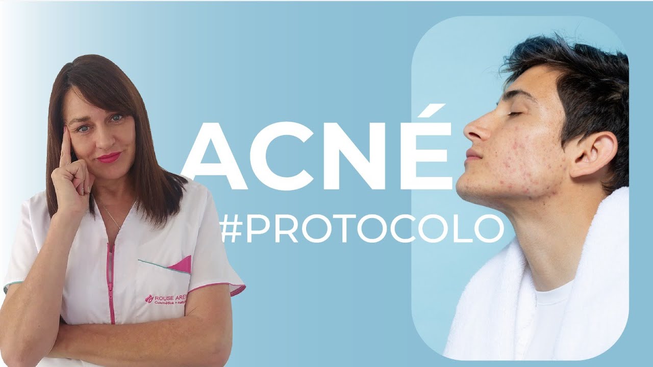 Paso a paso como tratar el acné