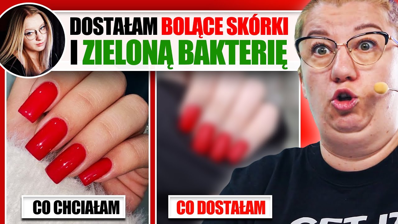 CHCIAŁA PIĘKNE PAZNOKCIE, A OTRZYMAŁA BÓL I ZIELONĄ BAKTERIĘ... | Co chciałam, a co dostałam