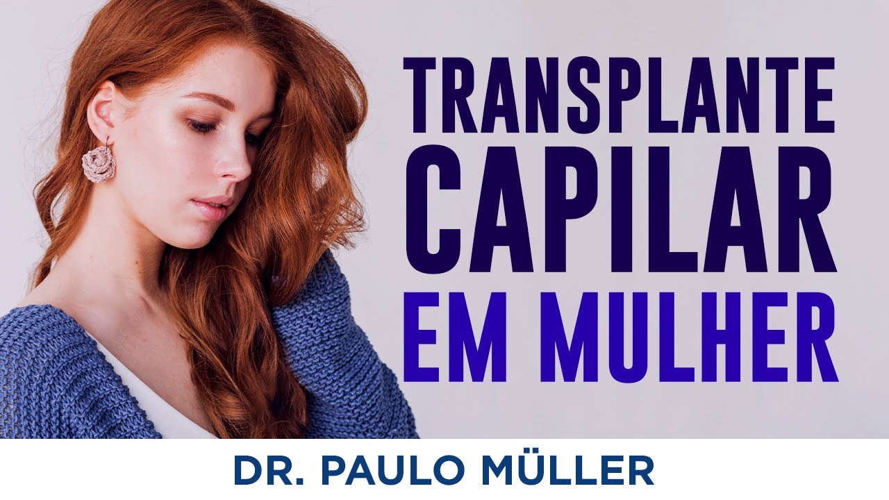 Transplante Capilar em Mulher, Como Ter Bons Resultados – Dr. Paulo Müller Dermatologista