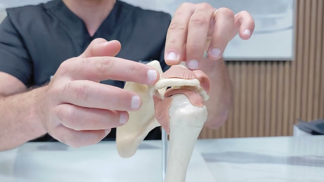 Luxação Acromioclavicular: Quando é Necessário Fazer Cirurgia?