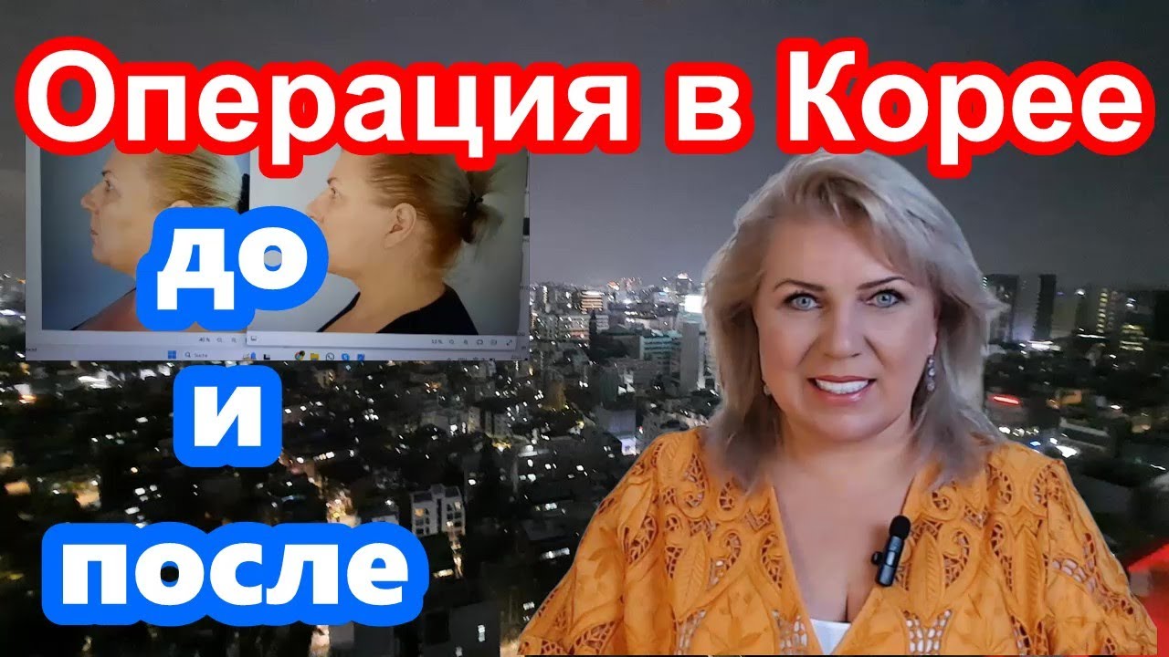 ОПЕРАЦИЯ В КОРЕЕ / ДО И ПОСЛЕ