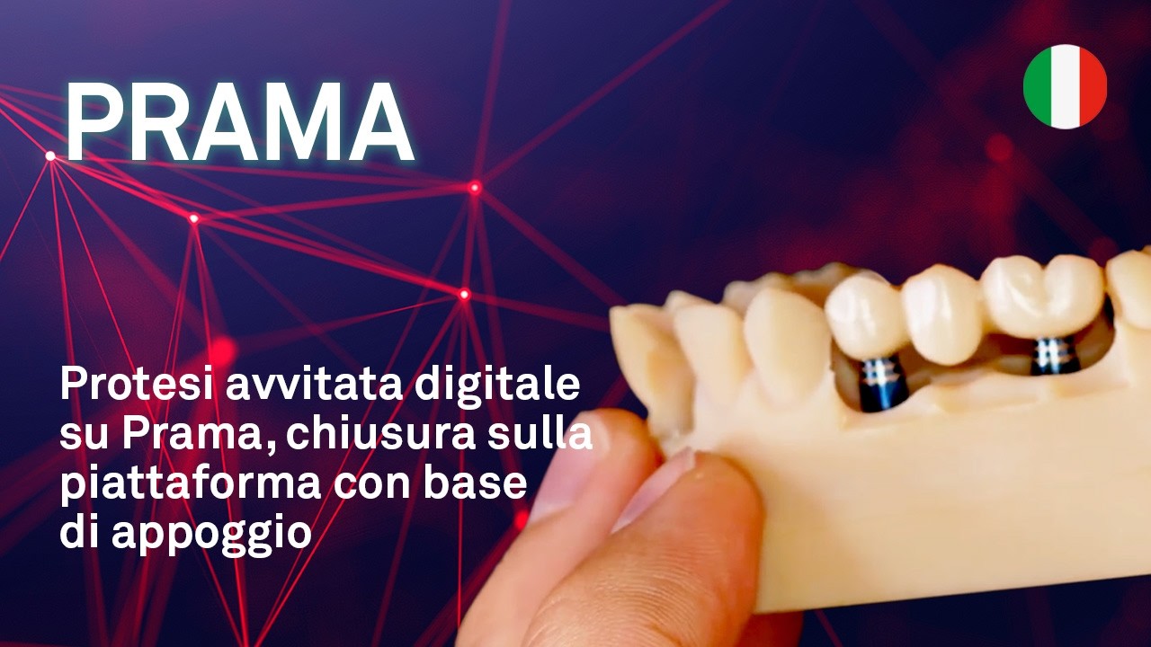 Protesi avvitata digitale su Prama, chiusura sulla piattaforma con base di appoggio