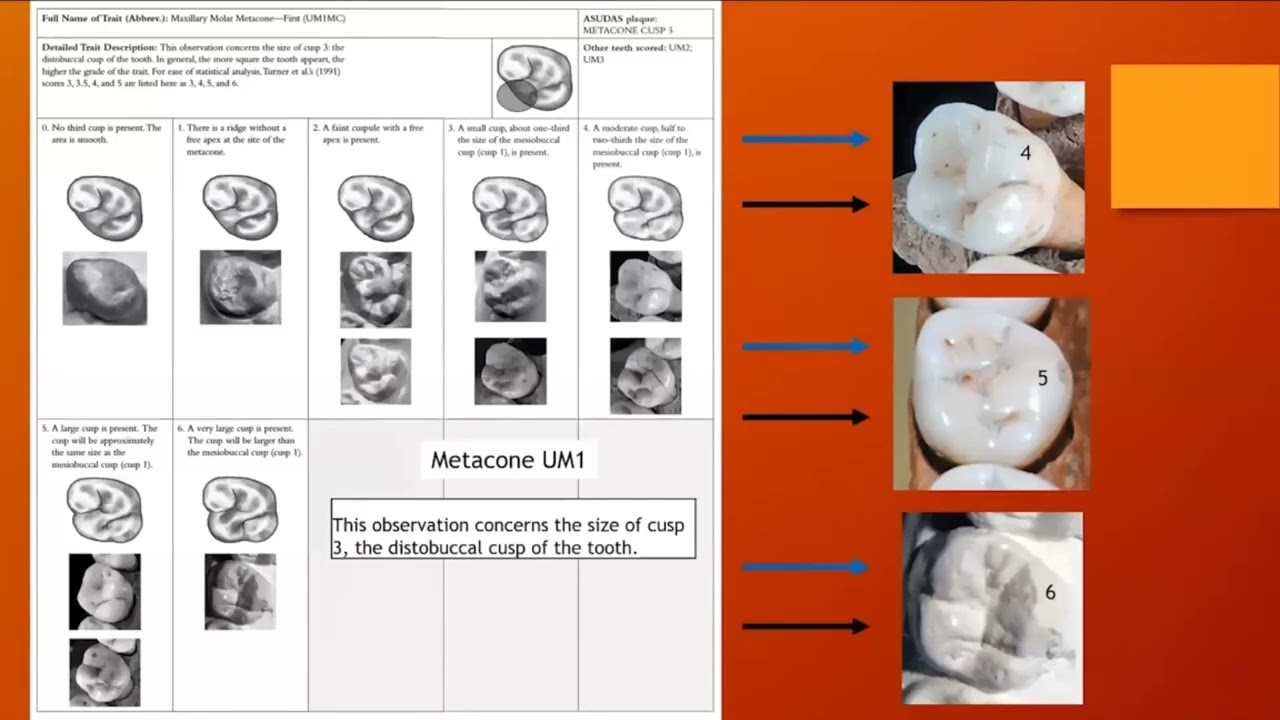 Dental Morphology: The Informative but Lesser-Known Traits