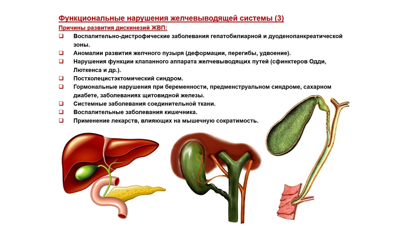 УЗИ. Доктор Иогансен. Выпуск 40. Функциональные нарушения желчевыводящей системы.