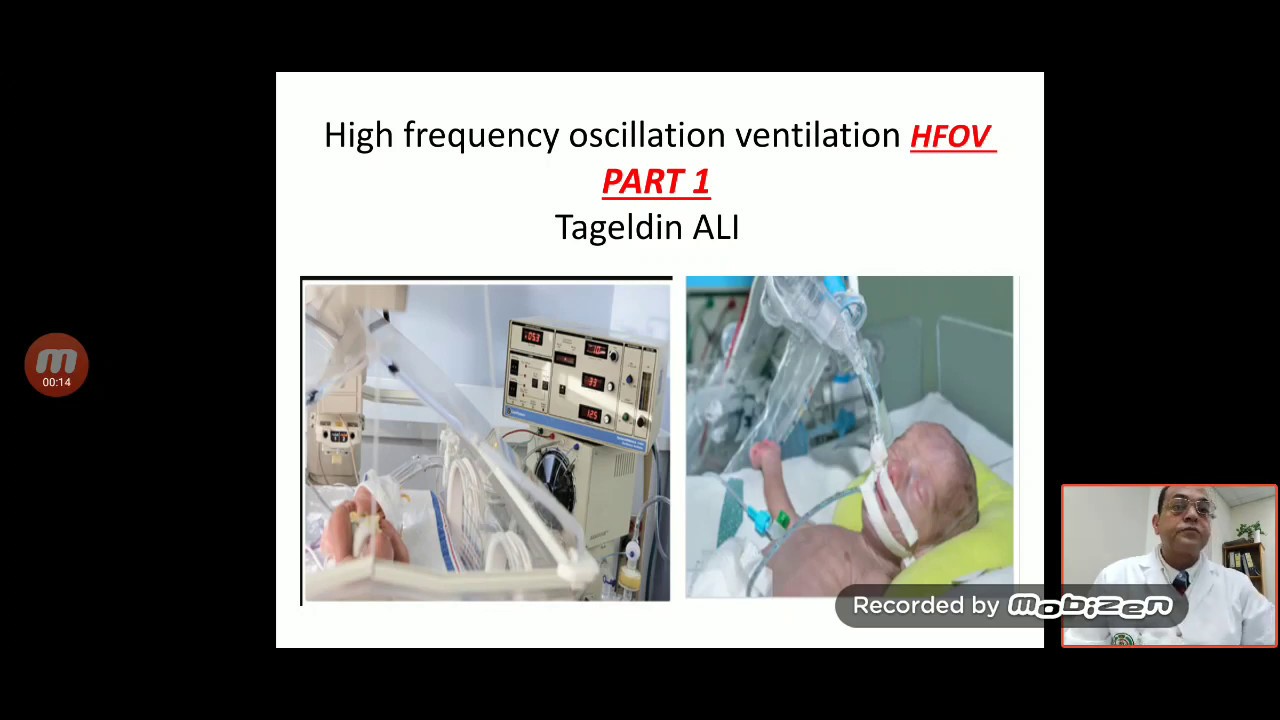 part 1 HFOV high frequency oscillation ventilation how does it work