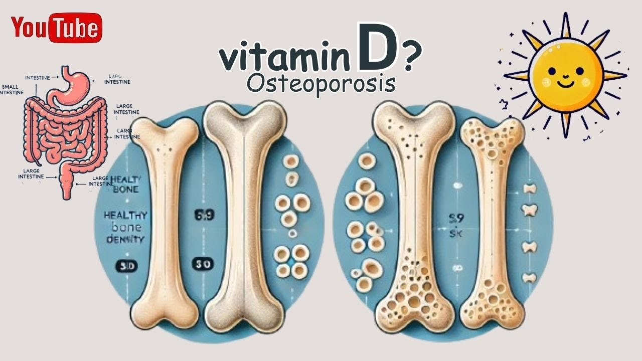【Vitamin D】 Pharmacology: Alfacalcidol, Calcitriol & Eldecalcitol Mechanism Simply Explained