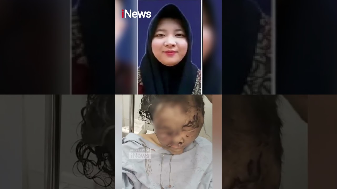 EKSKLUSIF! Kondisi Terkini Wanita Disekap Pacar 3 Tahun, Wajah Hancur dan Buta Permanen