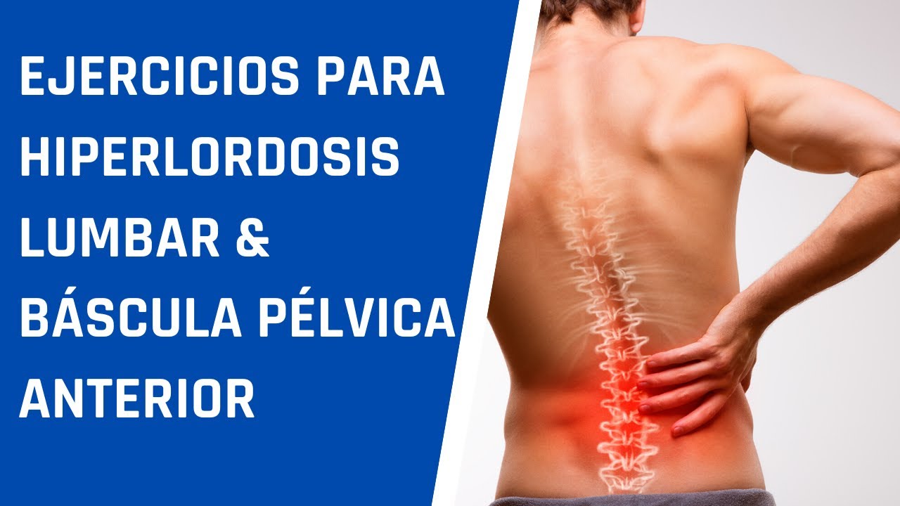 Ejercicios para mejorar la hiperlordosis y la báscula pélvica anterior