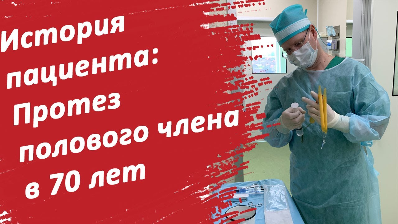 История пациента: Протез полового члена в 70 лет / Доктор Черепанов
