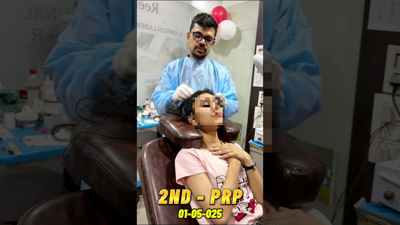 Female Hair Loss - Secret PRP Procedure Results #prptreatment #gfctreatment