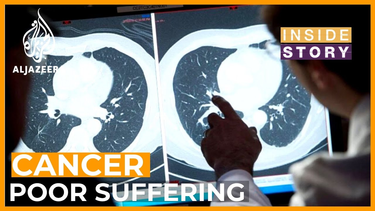 Why are the poor losing cancer fight? 6129525254001