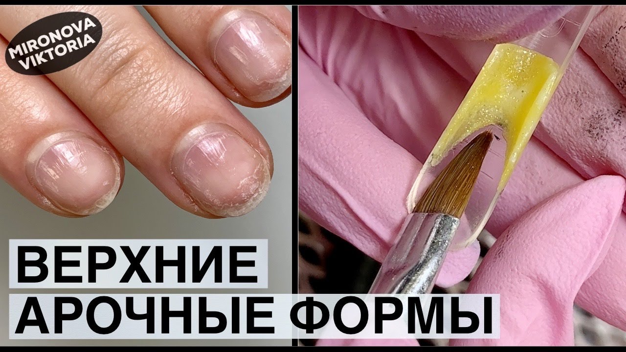 Верхние арочные формы/ Желтый выкладной френч/ Мультик на ногтях