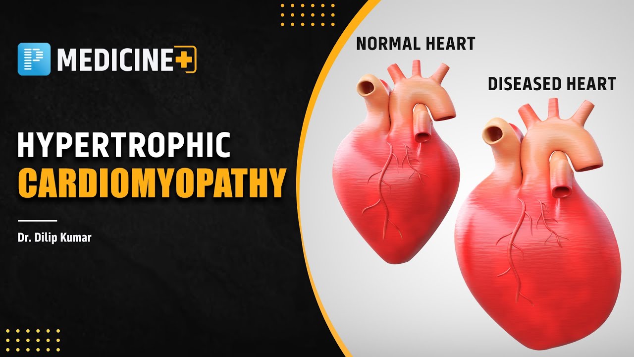Echocardiogram [General Medicine] - PrepLadder NEETSS