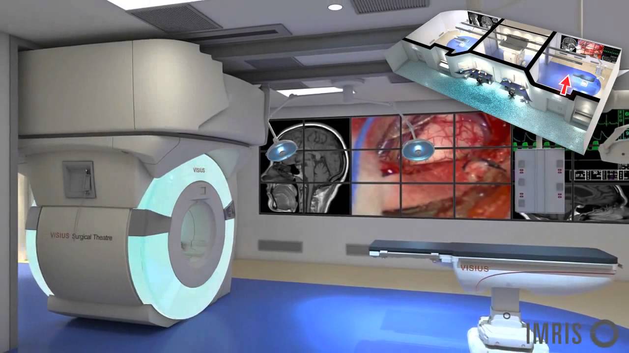 System IMRIS VISIUS - zintegrowany blok operacyjny (animacja)