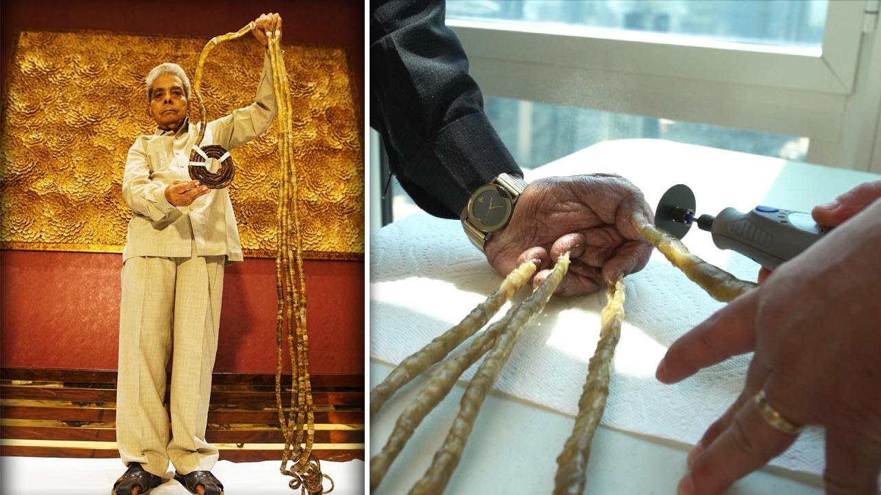 Indian Man With World's Longest Fingernails Flies to New York to Have Them Cut