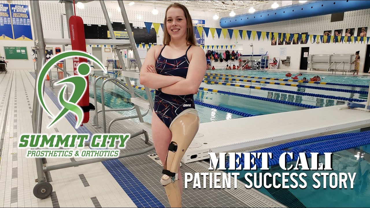 Amputee Success Story: Cali Prochaska