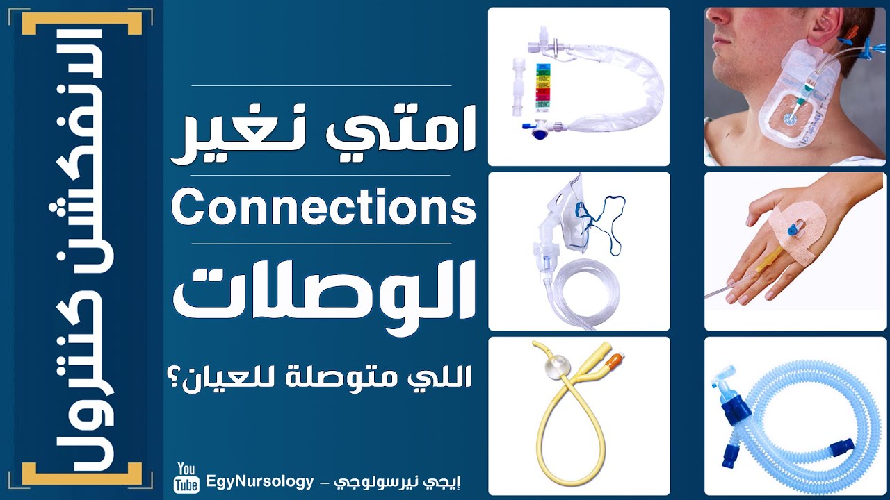 الانفكشن كنترول | (1) امتي نغير الـ (connections) الوصلات اللي متوصلة للعيان؟