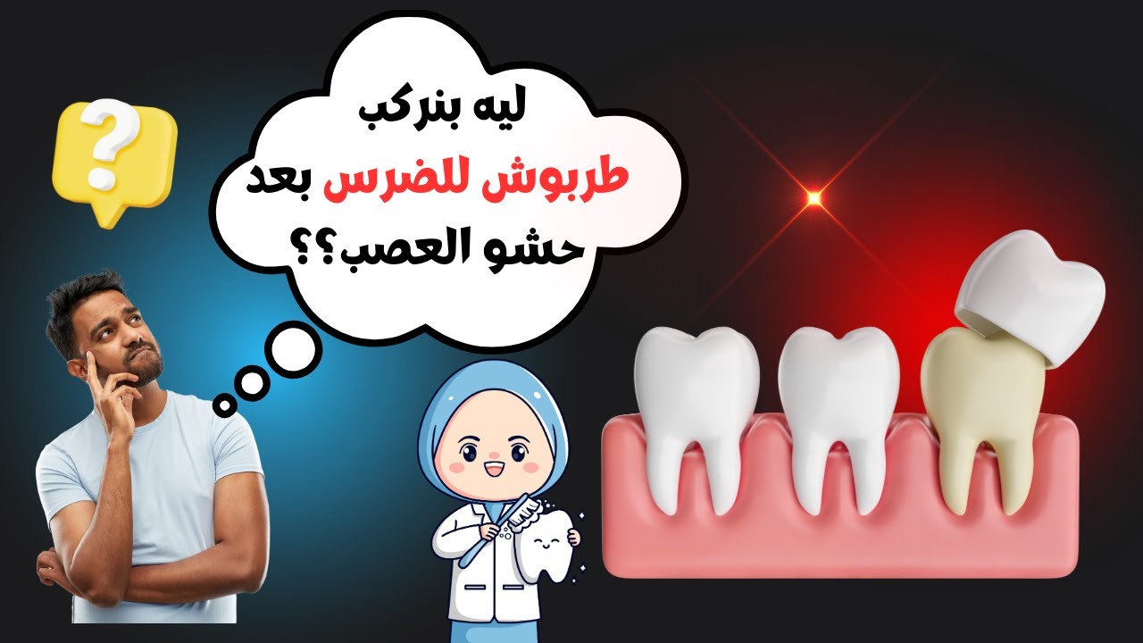 علاج الاسنان | تعرف على 3 فوائد لتركيب طربوش للضرس بعد حشو العصب| حكاية أسناني.