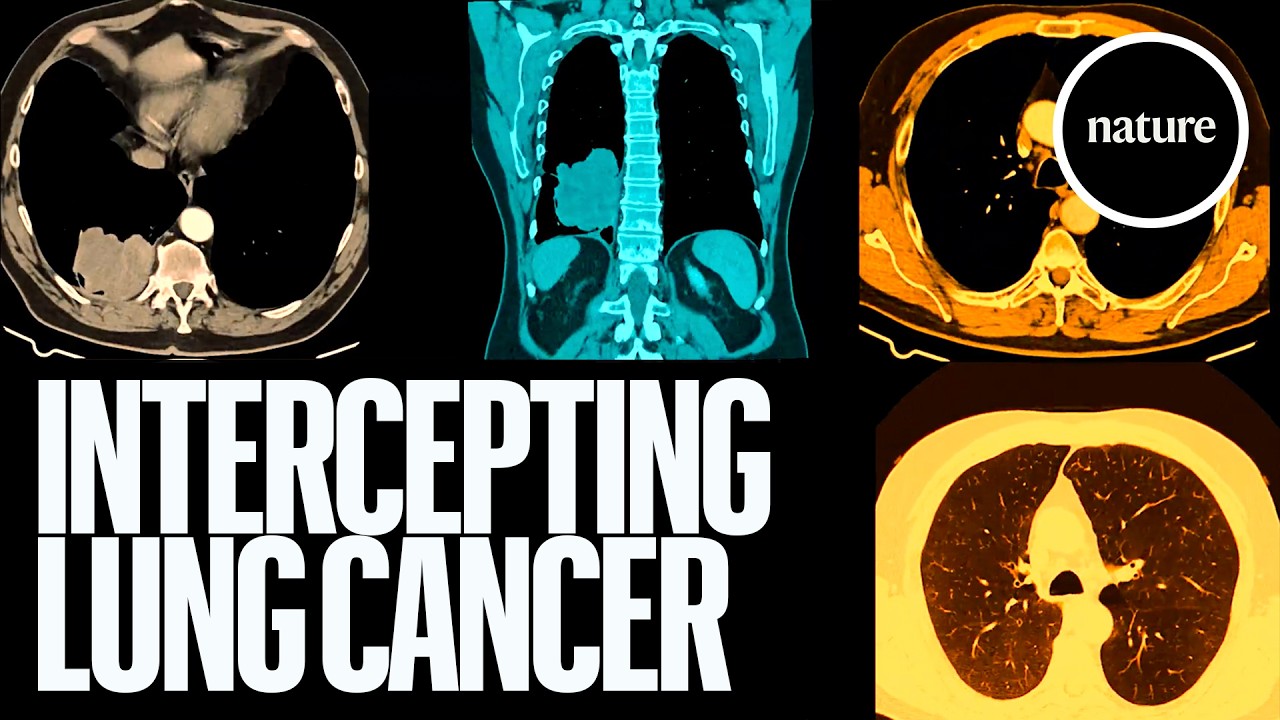 Could a pill prevent the world&rsquo;s deadliest cancer?