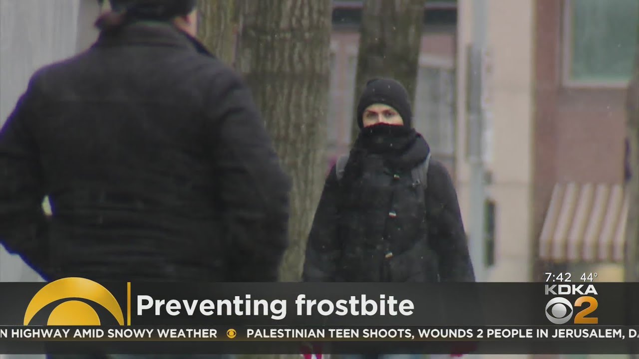 How to prevent frostbite