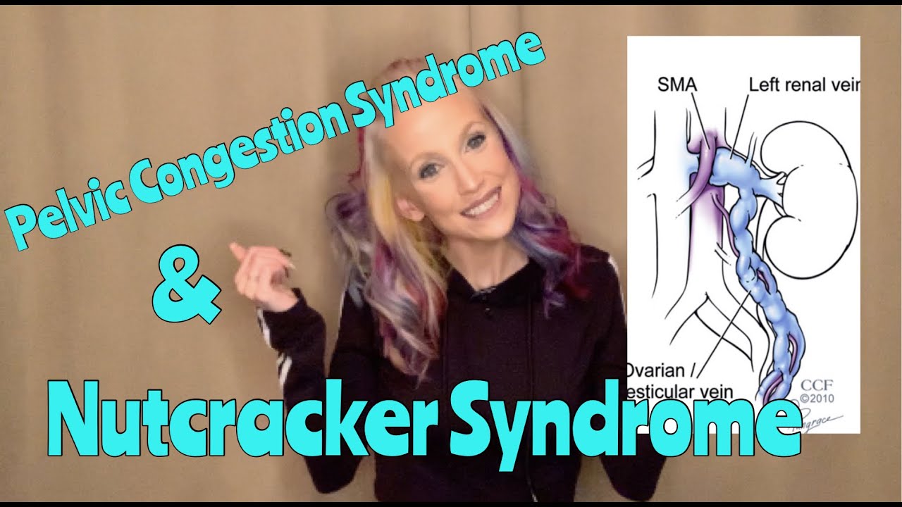 MEDICAL UPDATE!! FINALLY HAVE A DIAGNOSIS!! WHAT IS PCS & NCS??