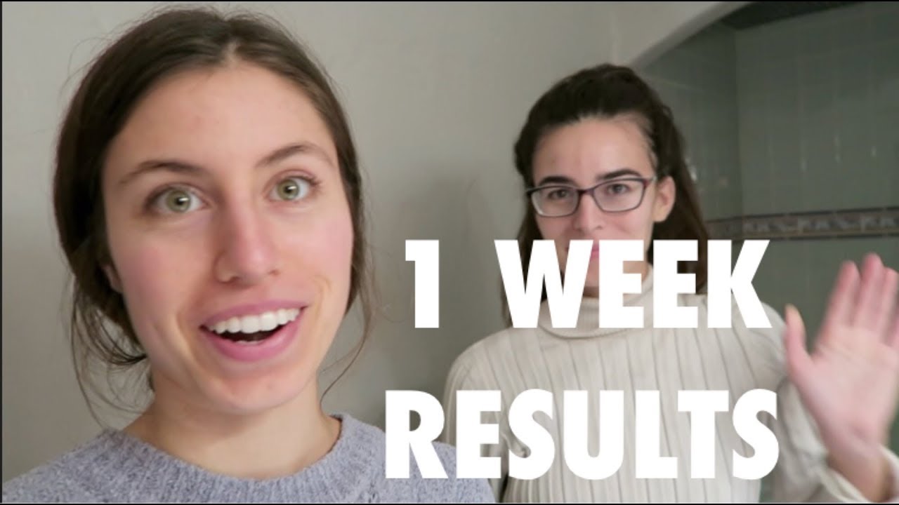 BEFORE AND AFTER | Acne.org 7 Day Results