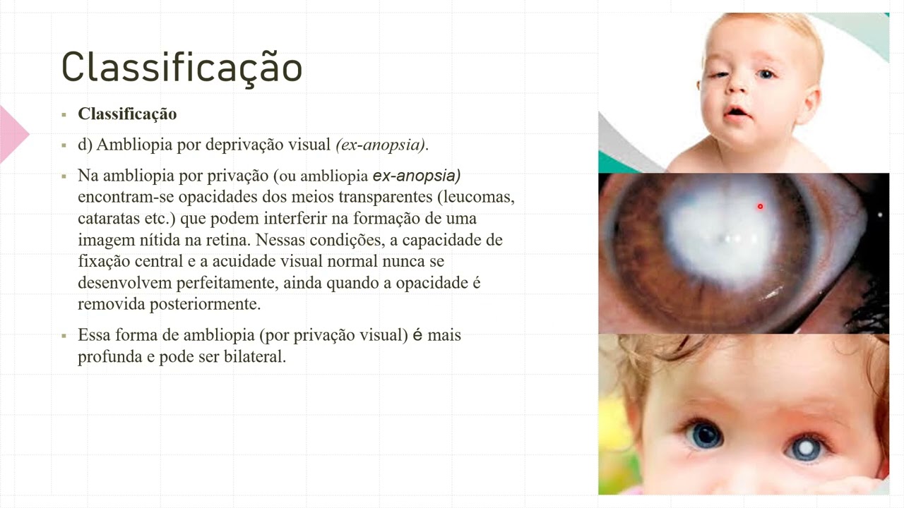 AULA 5 - programa estrabismo - AMBLIOPIA