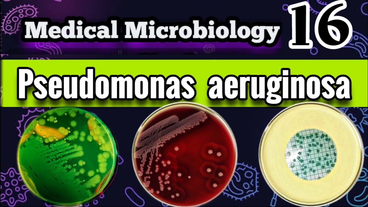 Pseudomonas aeruginosa شرح الشغل العملي