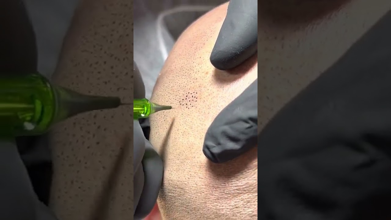 Blending Scalp Micropigmentation with Juan @GerowHairInk