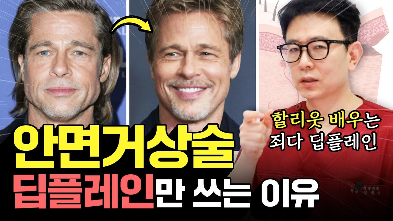 안면거상술 딥플레인이 대세가 된 이유