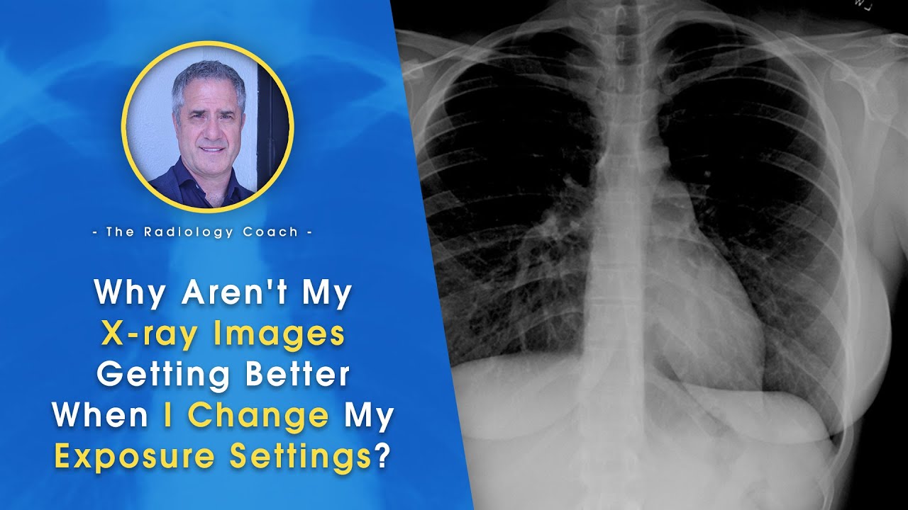 Why Aren't My X ray IMAGES GETTING BETTER When I Change My EXPOSURE SETTINGS???!!