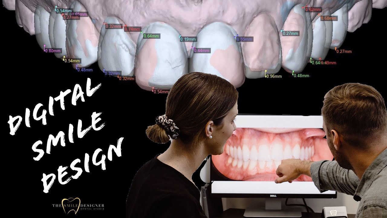 Digital Smile Design
