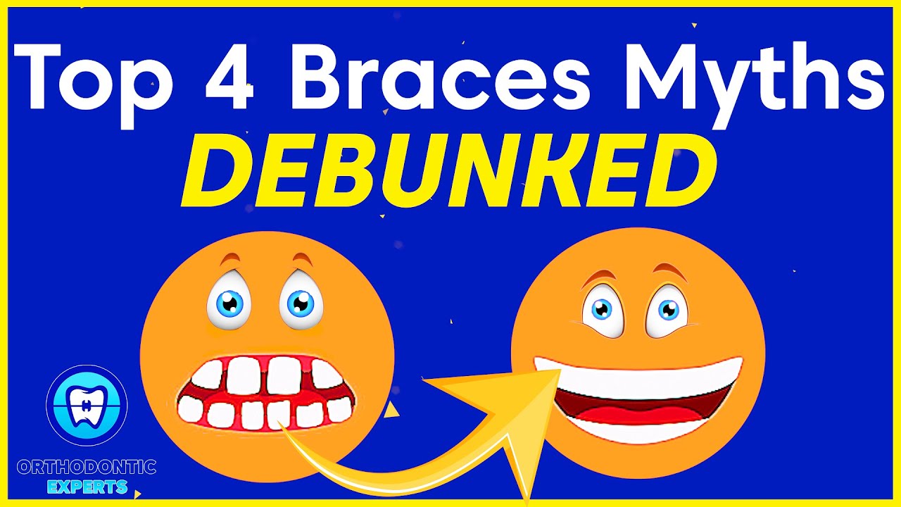Top 4 Braces Myths Debunked