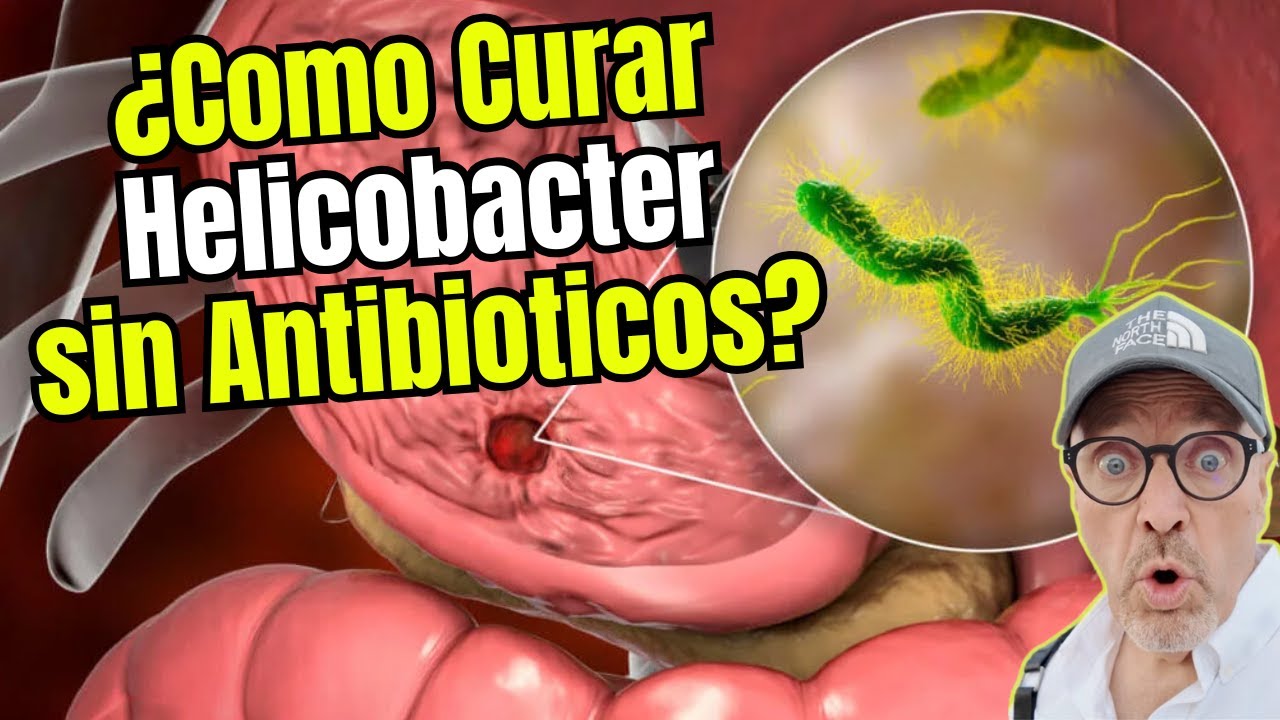 💙 ¿COMO CURAR EL HELICOBACTER PYLORI SIN ANTIBIOTICOS? 💙