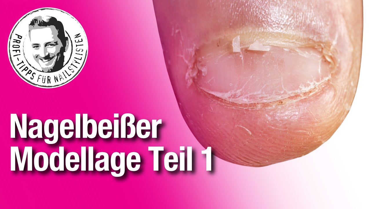 Nagelbeißer im Nagelstudio behandeln TEIL1