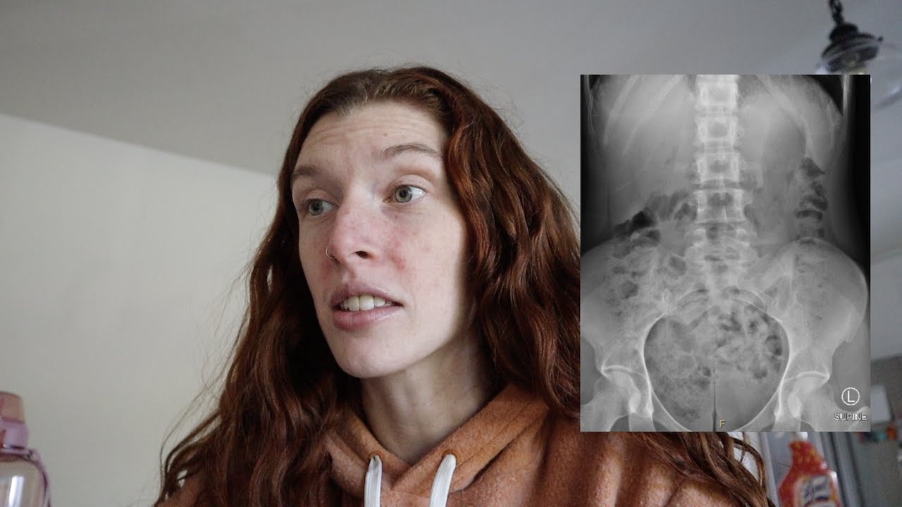 getting my x-ray results