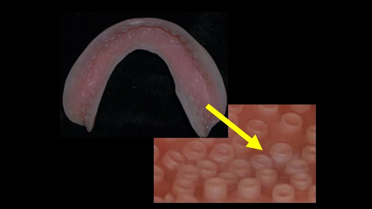 Do Your Dentures Suck? The Suction Cup Denture!!!