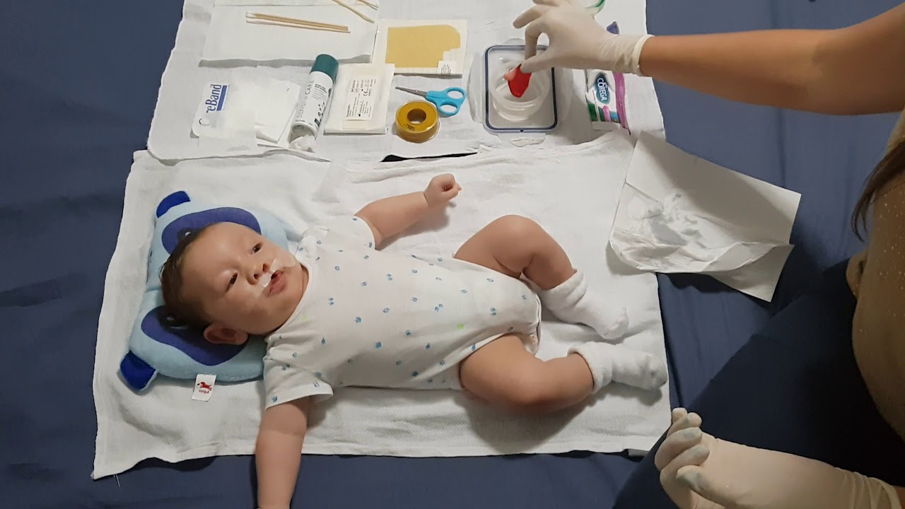 limpieza y cambio de placa obturadora para niños con labio y paladar hendido