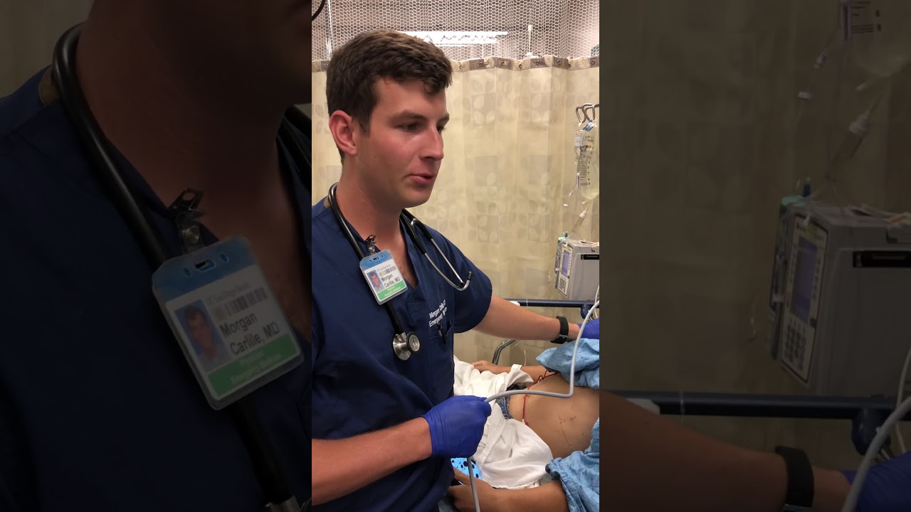 Positive ultrasound for pneumothorax