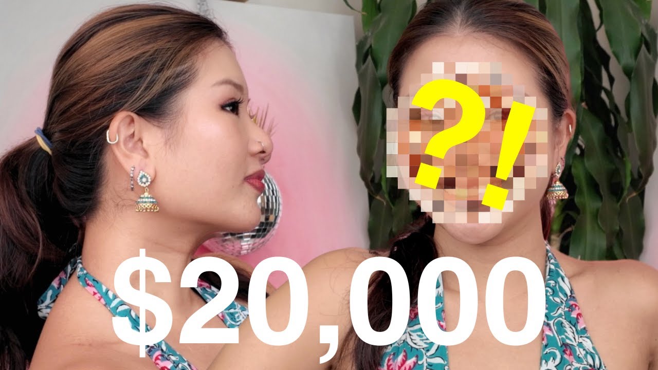 Which treatments are WORTH IT? | Skin boosters, Pico Laser, Botox, HIFU etc
