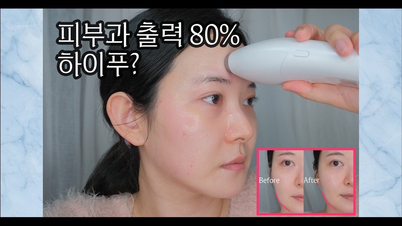 하이푸 린커브 언박싱부터 사용기까지 커브형 뷰티디바이스 밀착력이 좋다!