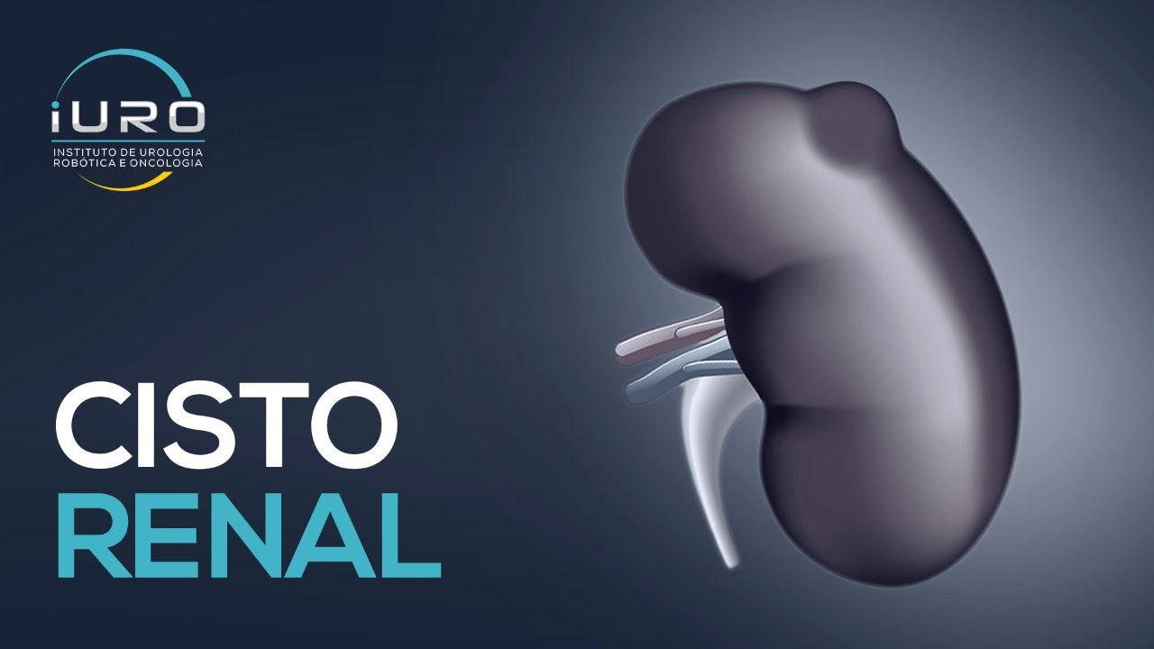 Cisto no Rim &eacute; perigoso ? Como eliminar Cisto renal ?